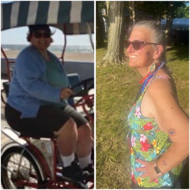 Suzie before and after