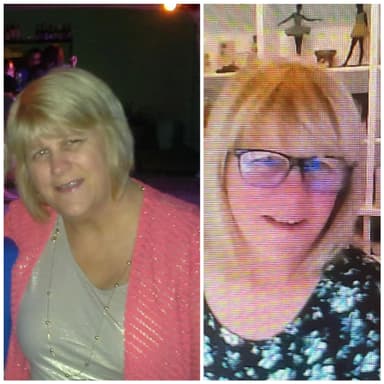 Jennifer before and after