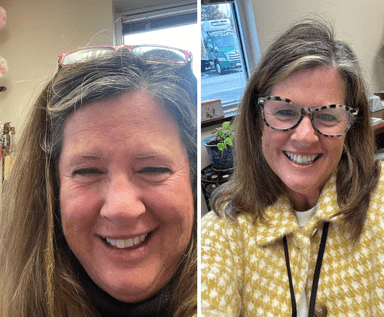 Anne before and after